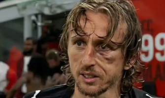 Modrić forbereder seg optimistisk til VM etter operasjon